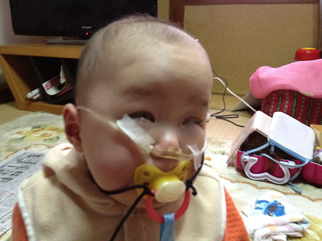 75 子供 の 目やに かわいい子供たちの画像